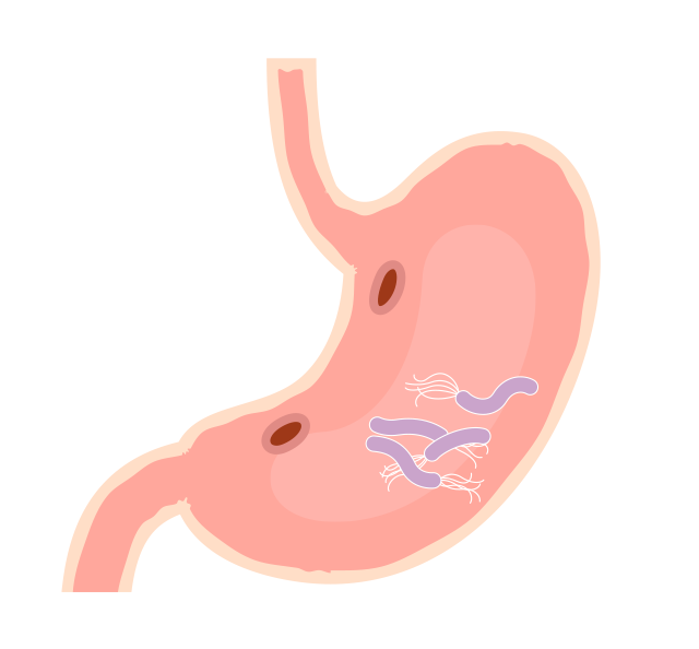 胃の中のピロリ菌のイメージイラスト
