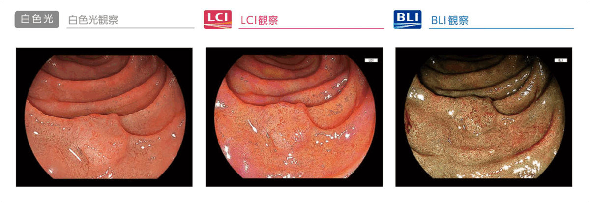 白色光観察・LCI観察・BLI観察